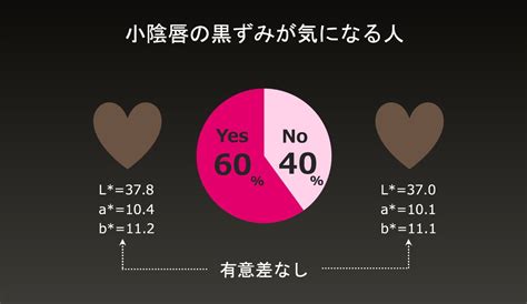 ビラビラ 黒い|小陰唇（ビラビラ）の黒ずみやサイズに関するお悩み。